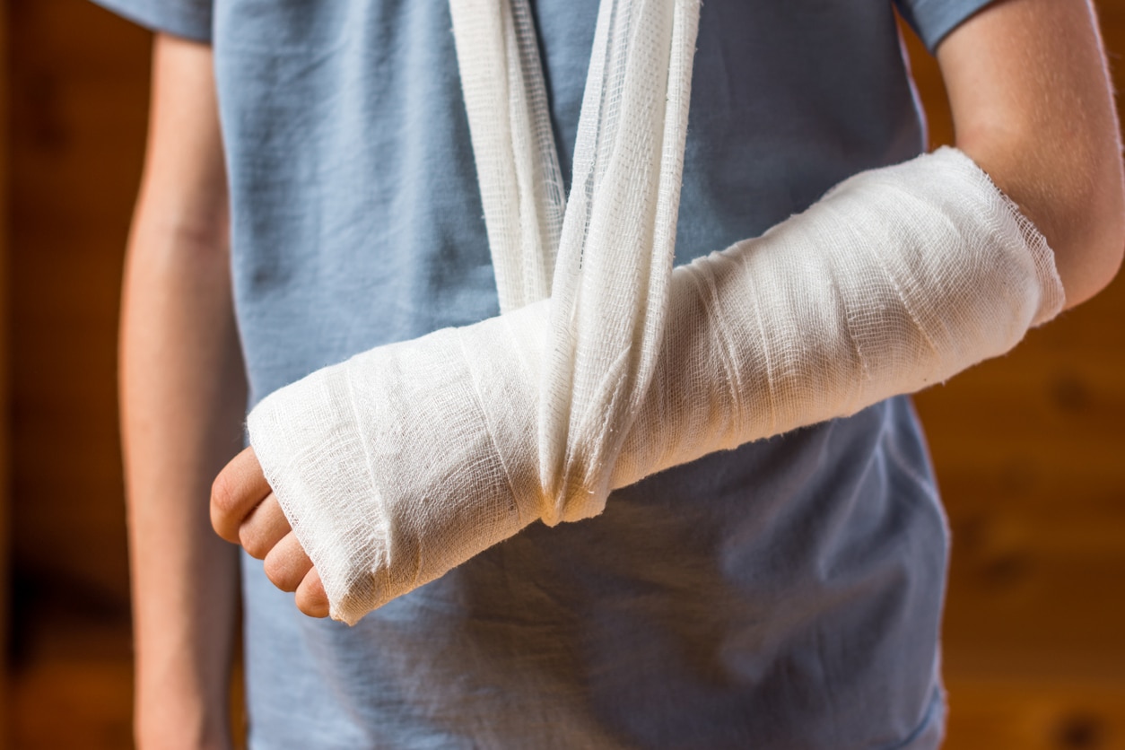 Boy with an arm in plaster