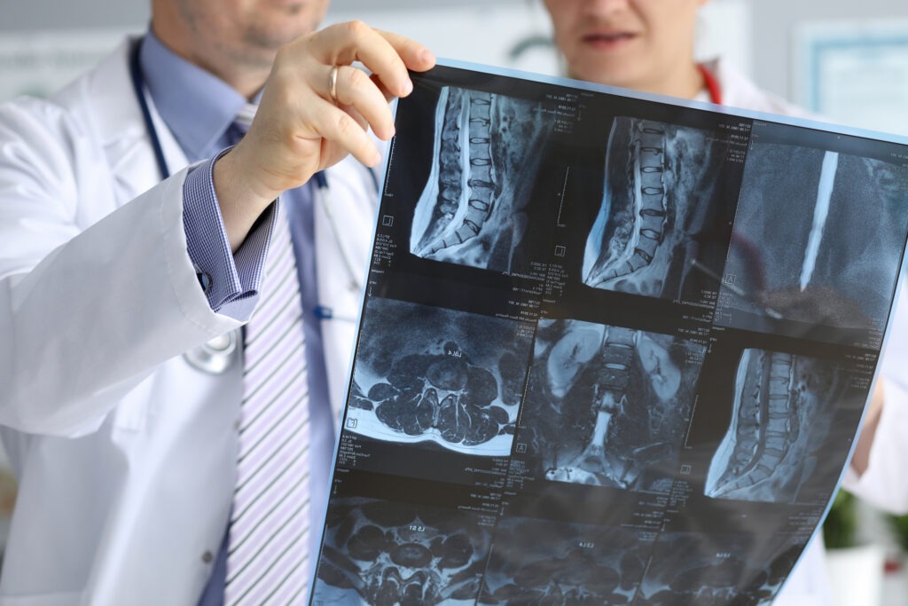 colorado spinal cord injury lawyer